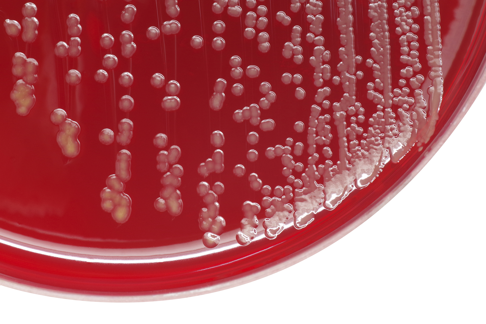Staphylococcus aureus bacterial colonies on blood agar plate